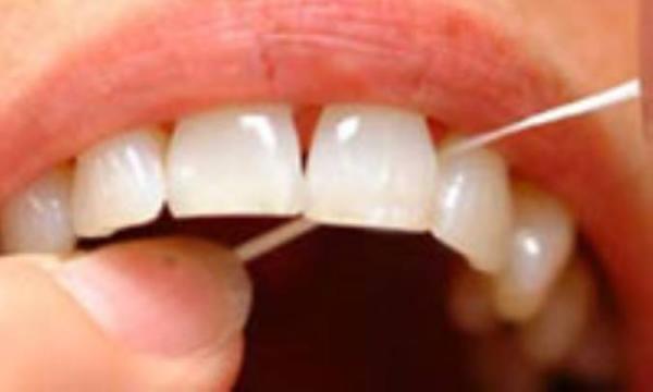 توصیه های نوروزی برای بهداشت دهان و دندان